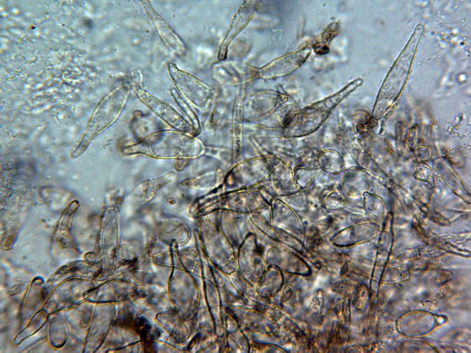 13 - Suprapellis agua x 400 2